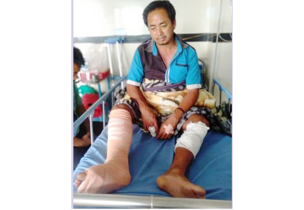 झापामा माछा पालन किसानमाथि छुरा प्रहार, आरोपी फरार